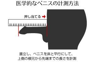 短小包茎とは！短小は何センチから？日本人の平均サイズや治療法 - アトムクリニック -