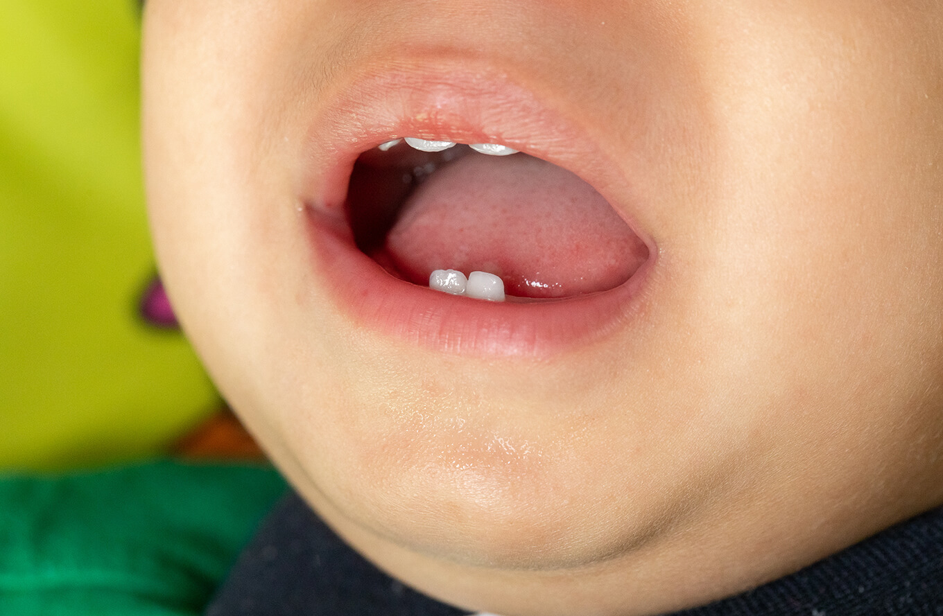 生後7ヶ月の赤ちゃんの特徴は？成長・発達・1日の生活リズム 小児科医監修PR:ウィステリア製薬読む・見る・学ぶ 子育てサプリ