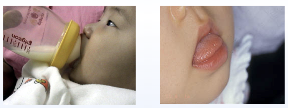 健やかなお口の育て方：乳幼児期のポイント 食生活 鶴岡市の歯医者石田おさむ歯科医院