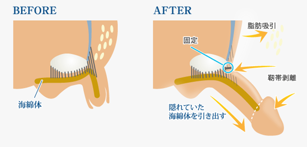 短小の基準は？短いちんこのちん長を伸ばし、粗チンを卒業する方法まとめ | Men's