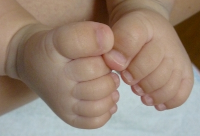 赤ちゃん・幼児の爪 Ｖ字に反る 変形・欠け・剥がれ1歳9ヶ月- ぼにょ朗育児日記