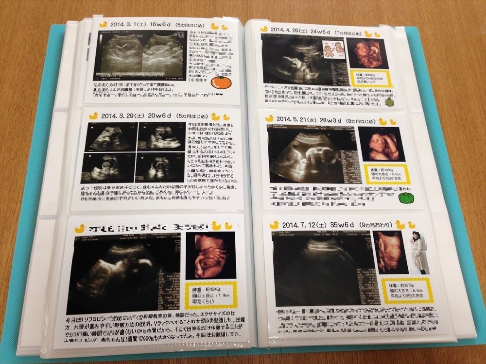 楽天市場 エコー写真アルバム 手作りの通販