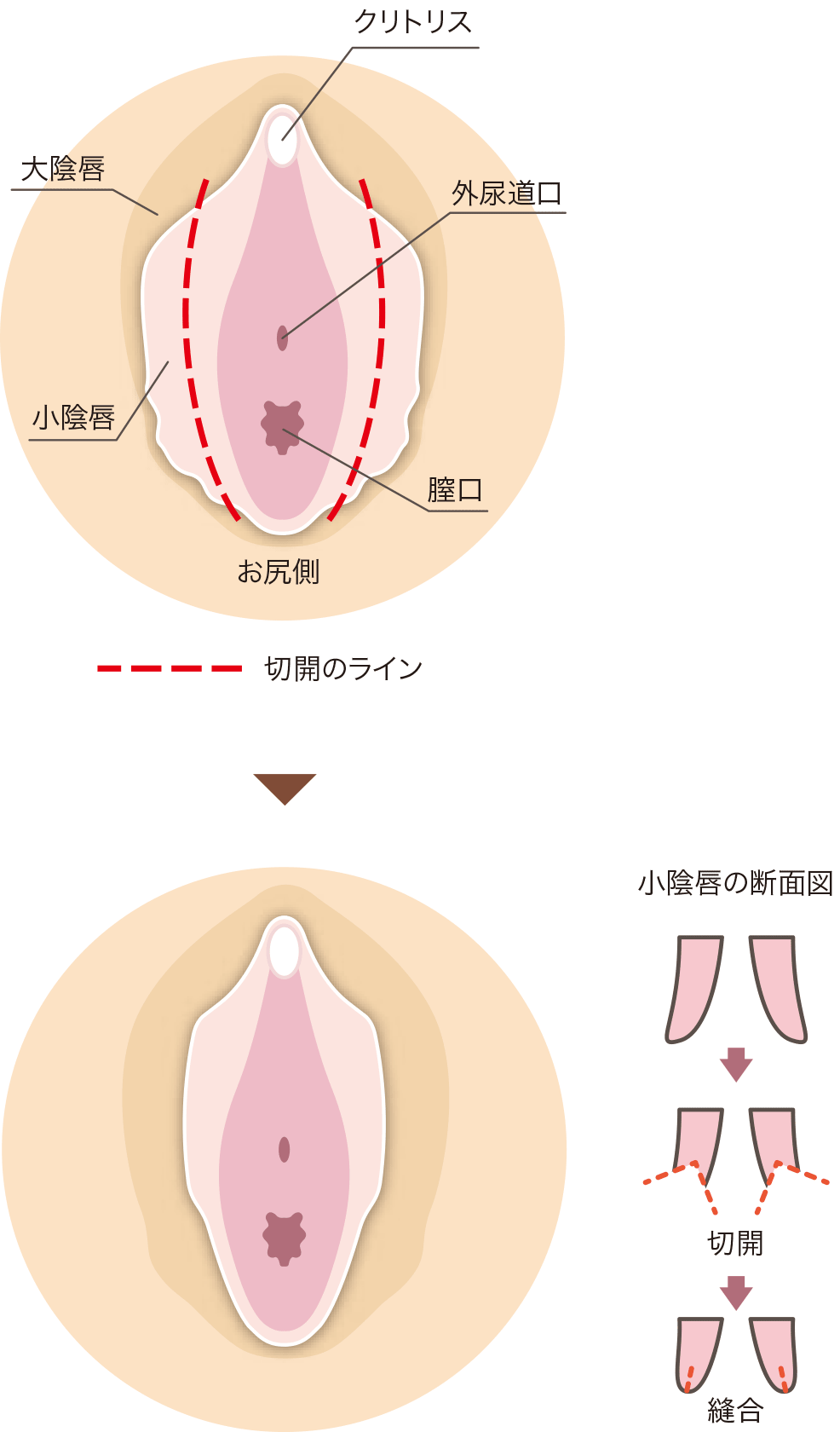 無修正 クリトリス search