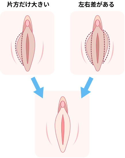 クリトリスは快感を得るための臓器であることを知っていましたか？