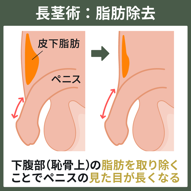 性知識イミダス：女性の生殖器を知ろう②外性器 | 連載コラム |