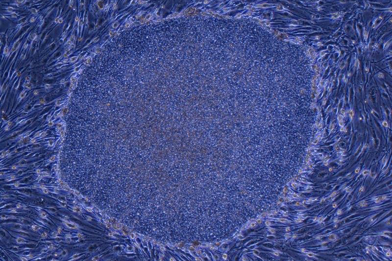 たくさんの小さな穴にゾッとするのはナゼ？謎の不安感「トライポフォビア」の正体ワーナーブラザース・ディスカバリー・ジャパン