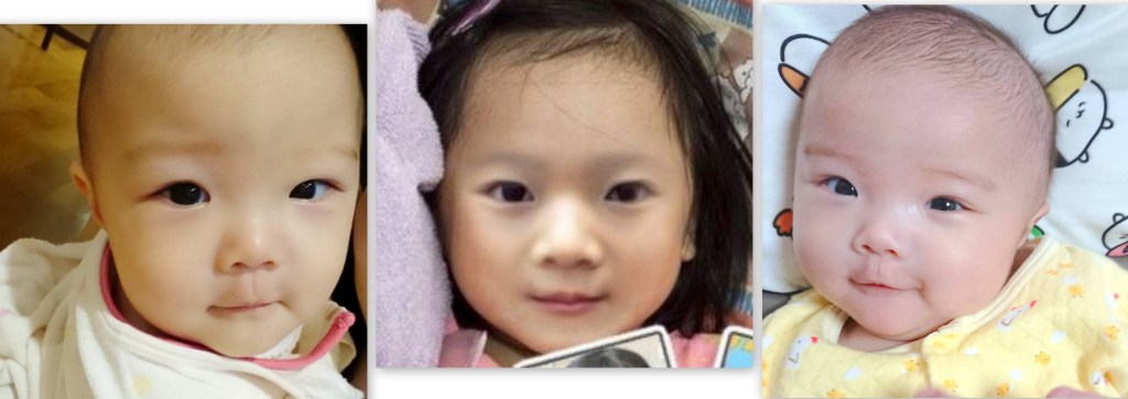 2025年無料版 赤ちゃんの成長後の顔 未来の顔 を予測するAIアプリと利用上の注意点