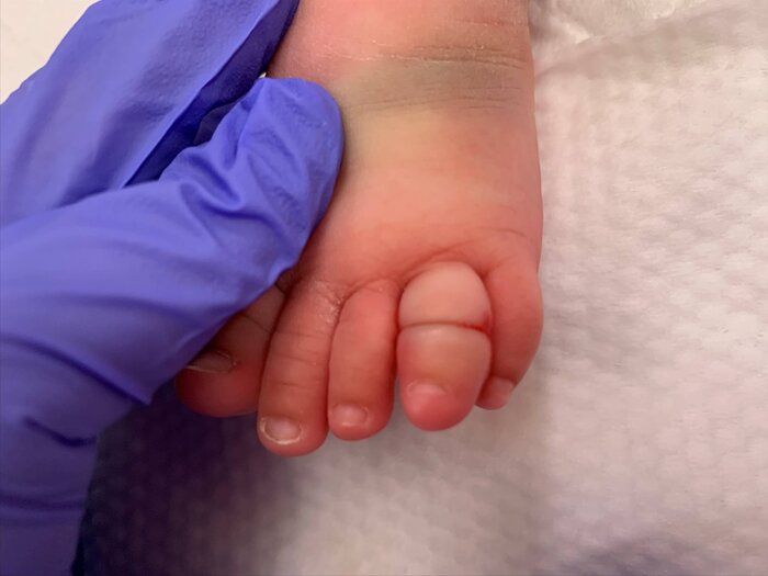 子どもの足の指が丸まっている!? よくある原因と足の指の力を高める方法みやざき足育センタ