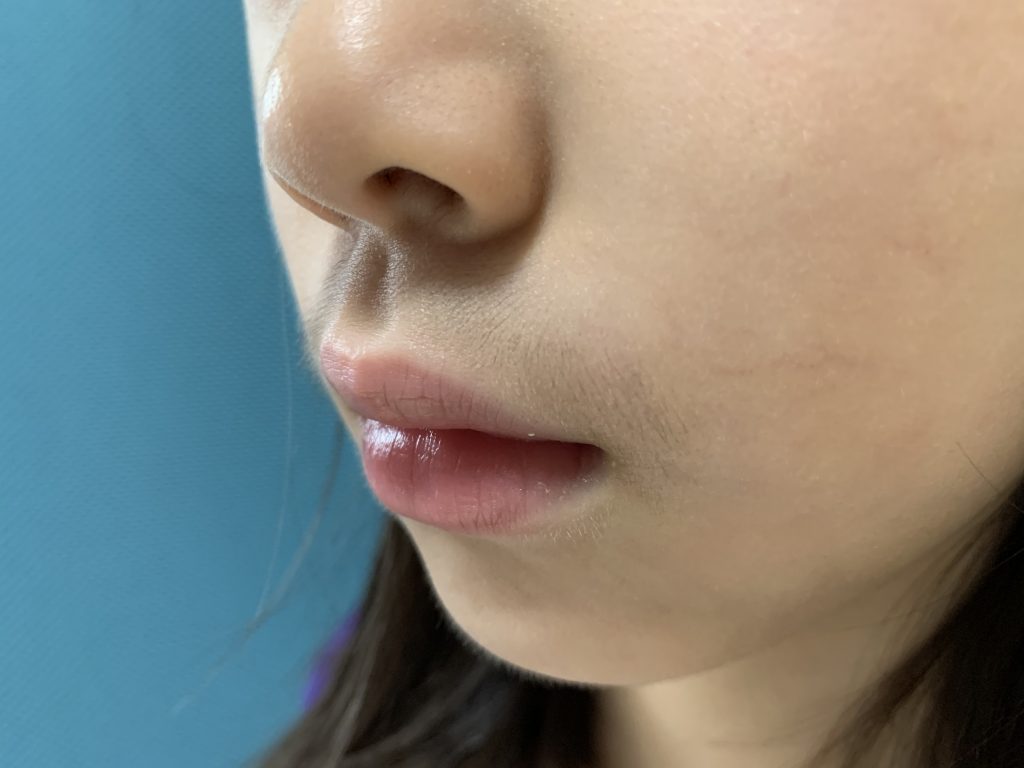 家族と触れ合うその肌、ジョリジョリじゃもったいない。NEWSCAST