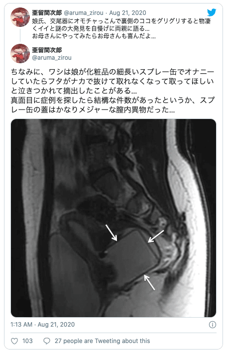 アナルセックスが出来る身体、って凄く無いですか？ : 【拡張改造研究室】