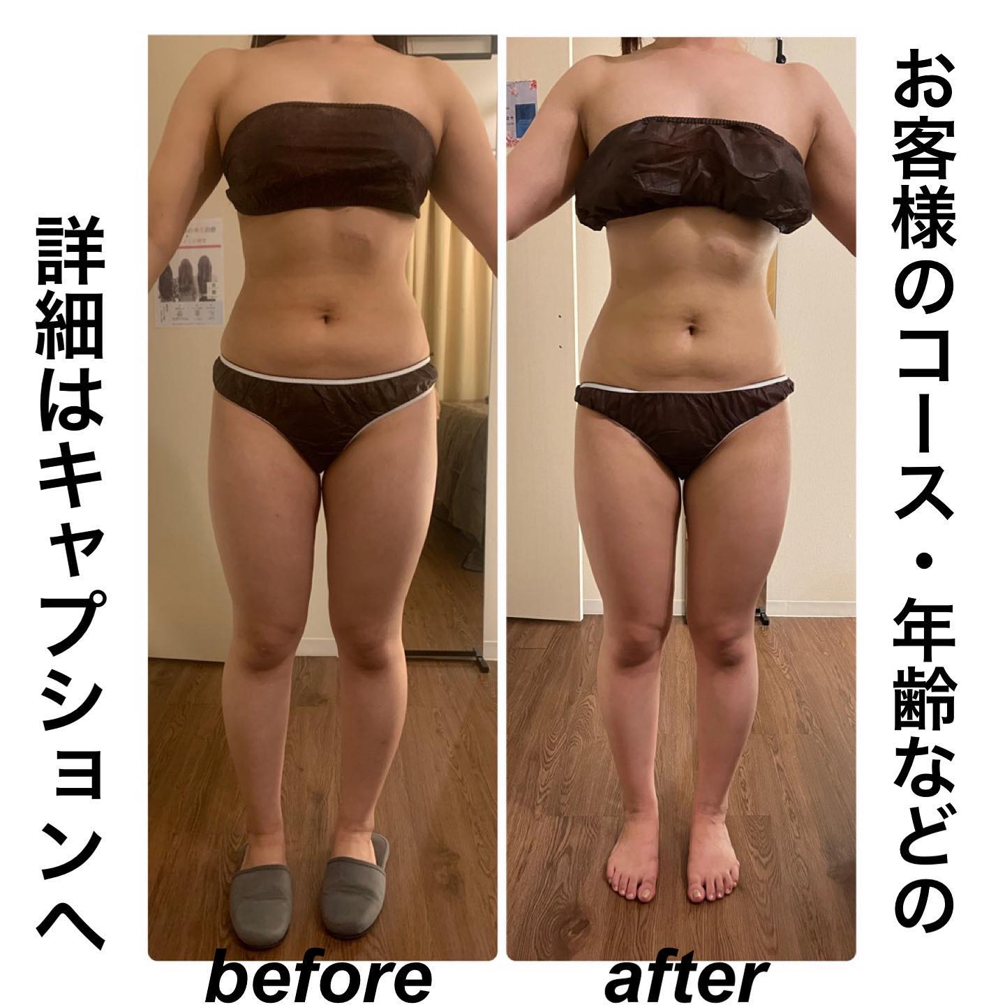 春エステ特集【大阪×痩身ダイエット】初回体験が安い！お得なキャンペーン（季節特集）｜エステ・人気ランキング