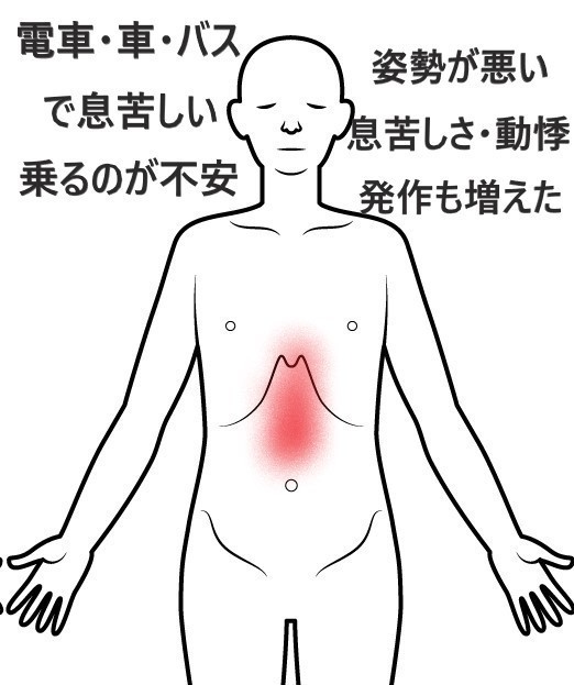 げっぷ ｜ ツボネット 鍼灸の症例が検索できるツボ辞典