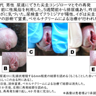 女性用風俗は本番あり？女性向け風俗の挿入実態や利用方法を徹底解説 - Shizuku（シズク）