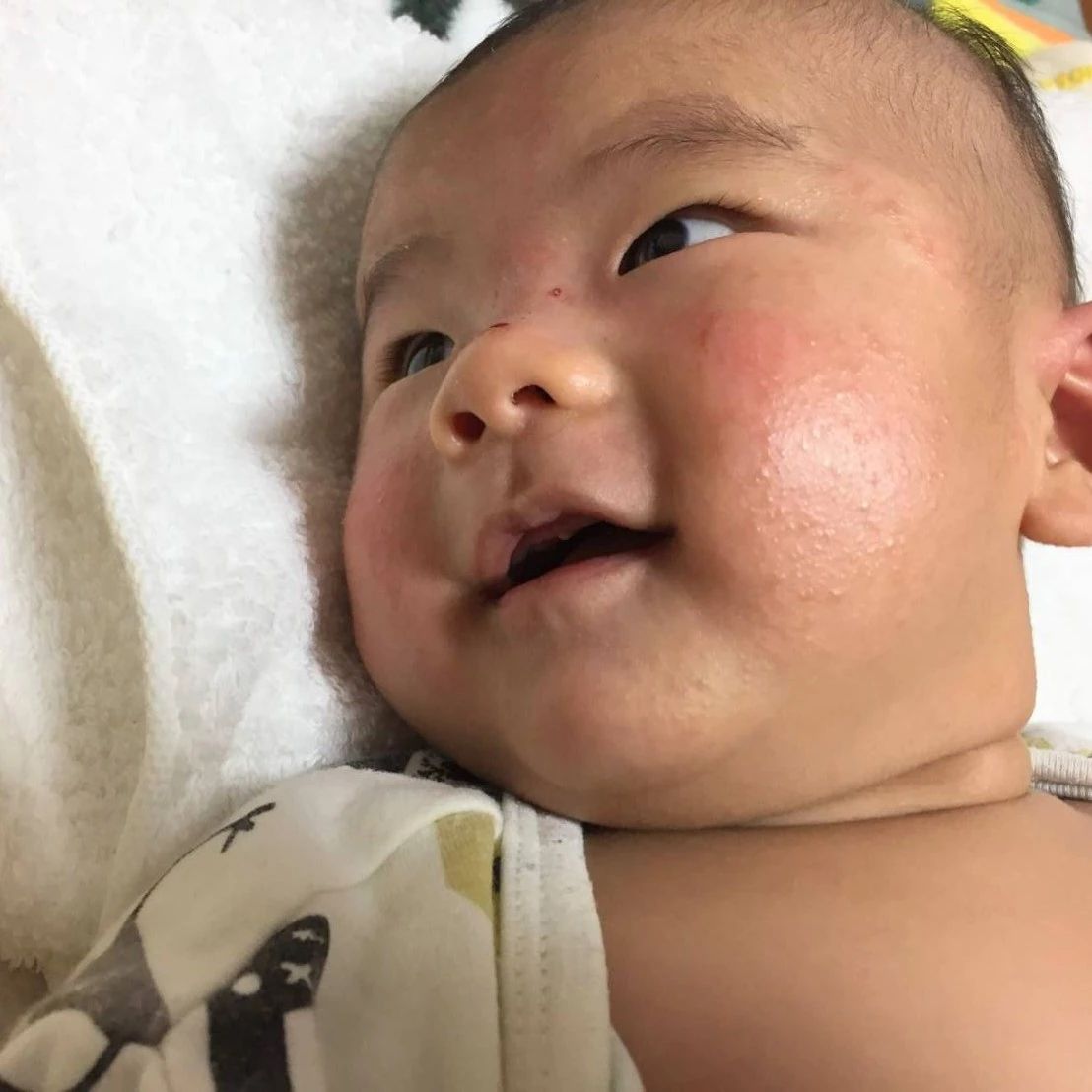 法令線――電車の窓に映った顔が気になるときアンチエイジング美夏クリニック