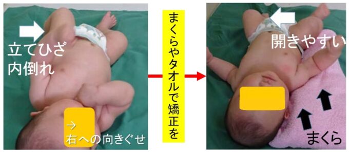 両足をぴんと伸ばして座る赤ちゃん?: 保育 Care and Education の専門性を高めるページ