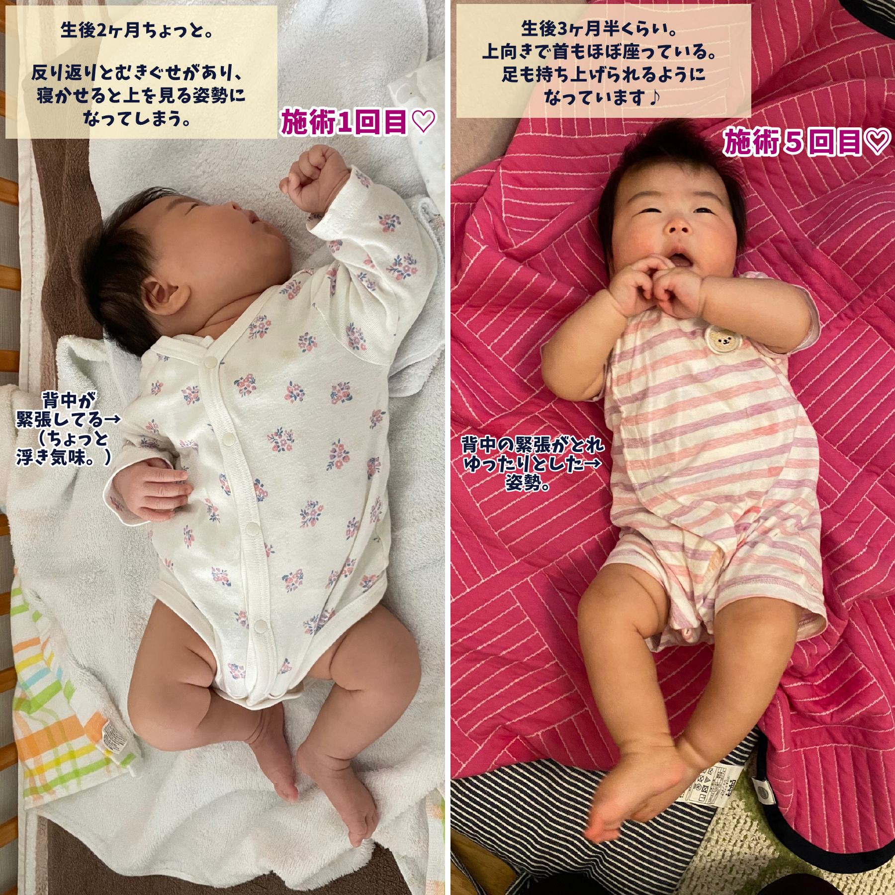 M字開脚寝相はいつまで続く ？ 気になる三男の足のこと by tomekko - みんなの体験記 妊娠・出産・育児