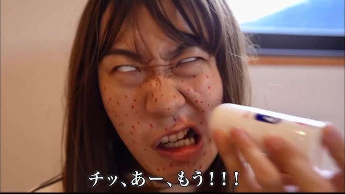 集合体恐怖症の方ゴメンなさいね。 蒼太のお鼻のつぶつぶー👃🏾