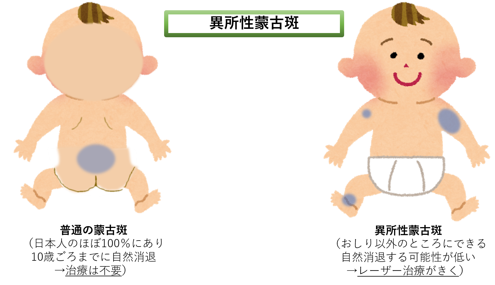 お尻野田市 小児科 千葉県 こどもの花粉症 こどもの漢方 喘息 アトピー性皮膚炎 アレルギー 結節性痒疹 たんぽぽこどもクリニック