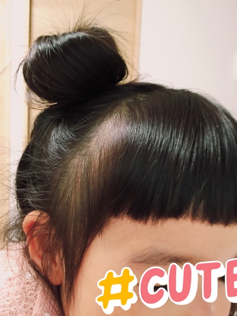 100均グッズでミニーちゃんヘアのお団子を可愛く作る方法育児ブログぷっぷくほっぺ