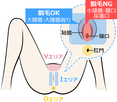 パイパン(ハイジニーナ)の女子は本当に魅力的なのか？男性陣に聞いてみた | まじまじぱーてぃー