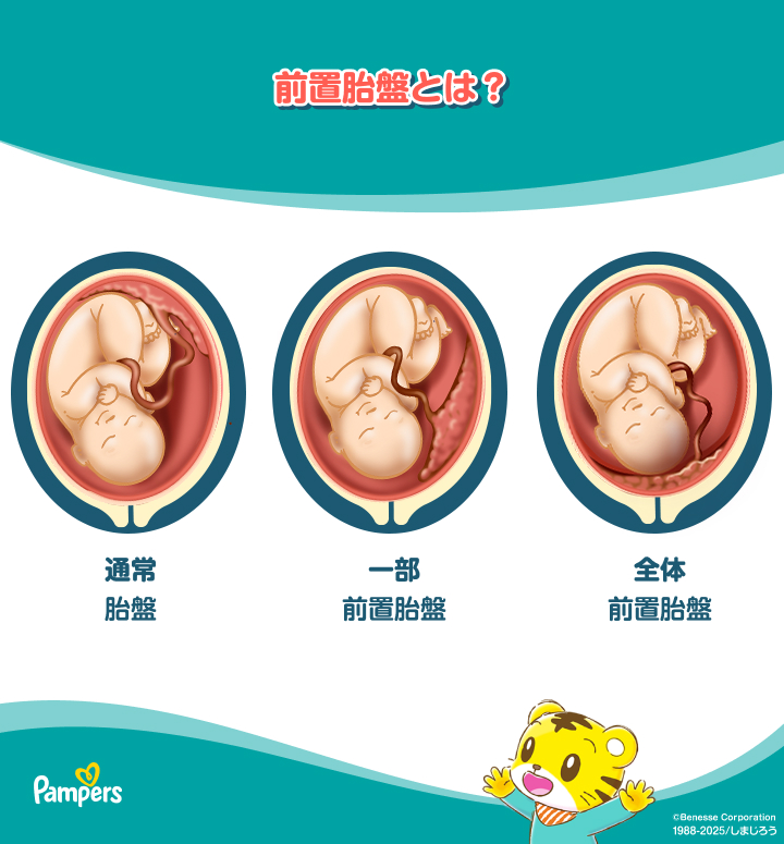 妊娠3ヶ月目 妊娠8～11週の胎児の様子・母体の症状や気を付けること妊娠初期All About