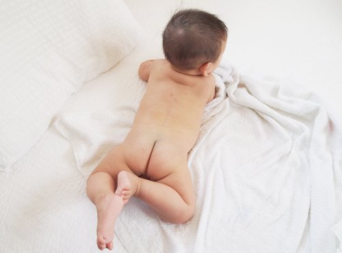 赤ちゃんのお尻のただれ、腫れ はれ 、膿 うみ がでる原因：肛門周囲膿瘍 こうもんしゅういのうよう とは？国分寺市の小児科 小森こどもクリニック