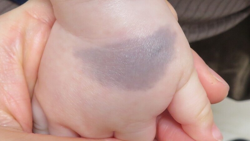 ムーニーおしりキレイシャワー-おむつのムーニー 公式 ユニ・チャーム