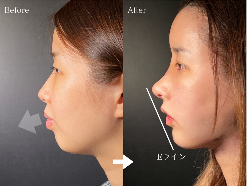 韓国BEAUTYまとめ もうコンプレックスじゃない! ほくろが魅力的な韓国の女性芸能人はだれ？ - DANMEE ダンミ