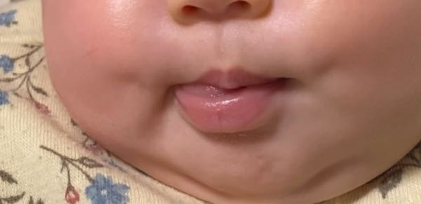 可愛いえくぼの作り方とその魅力2025 年のリアルなLemon8ユーザー体験