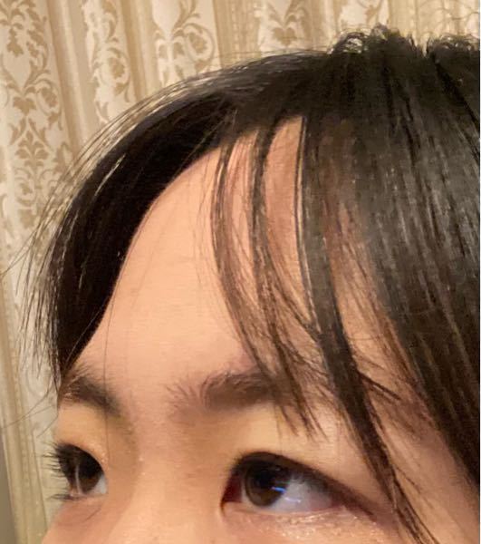 片目だけ二重になるのはなぜ？雌雄眼の魅力と左右差をなくす方法Shinagawa Beauty Navi