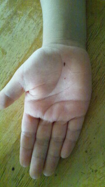 実は凶相！ 手のひらの「ほくろ」の意味とは 手相占い 「マイナビウーマン」