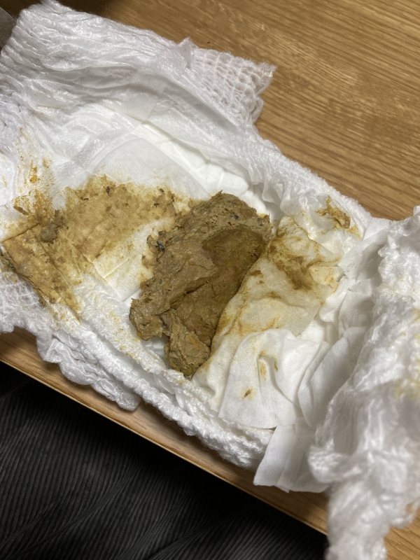 YWJLQH 感覚の発達と調整のための子供の回転便, 白 胆道閉鎖