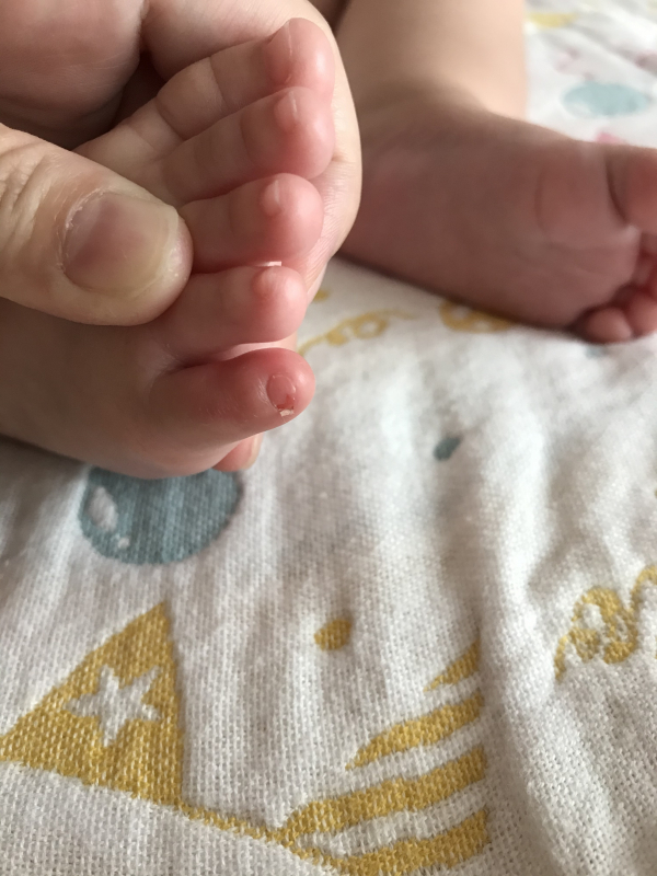 サロンでの足の爪お手入れ方法と注意点