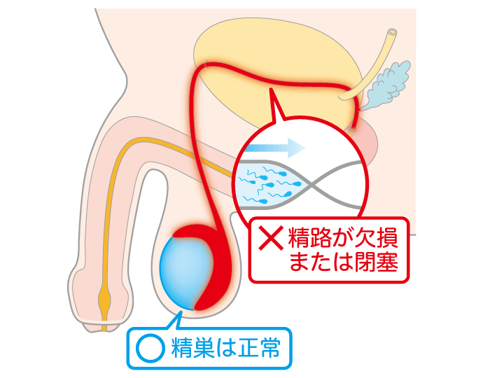 寝ながら出てしまうのはなんで？夢精 をしたときの対処法は？汚れたパンツやシーツの洗い方【12歳までに知っておきたい男の子のためのおうちでできる性教育】（ラブすぽ）｜ｄメニューニュース（NTTドコモ）