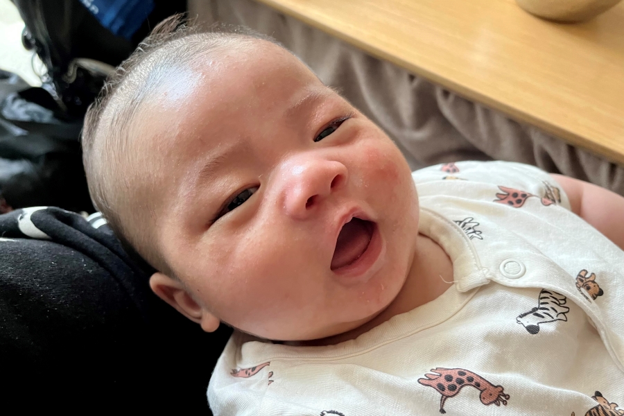 子どもの顔にできた赤いブツブツは乳児湿疹？原因やケアの方法ベビーケア妊娠・育児のお役立ちコラム無添加せっけんとハーブのアラウ