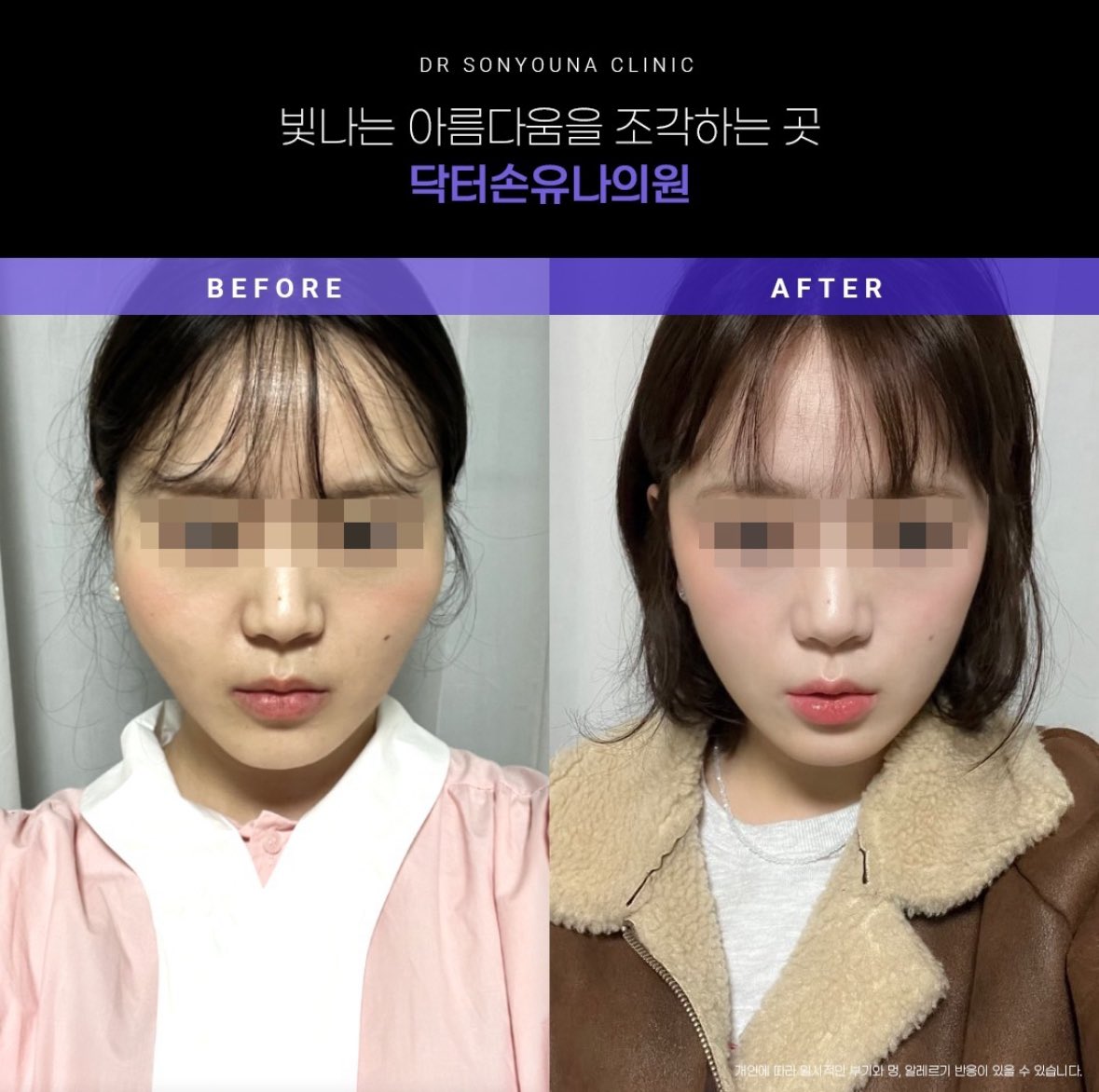 女優キム・ヘス＆ソン・ユナ＆ユソンら、”10年目の友情”を誇示Infoseekニュース