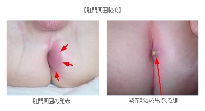 あかちゃん みーつけた！ひらぎ みつえ絵本ナビ：レビュー・通販