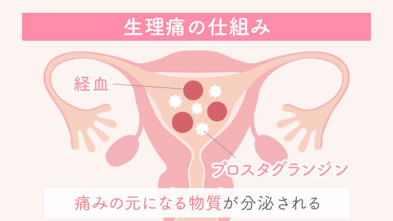 性行為で頭痛 その原因は？危ない病気？ -