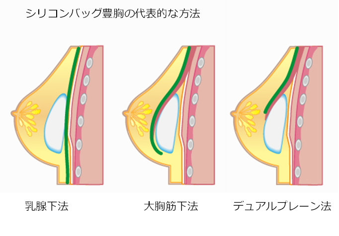 後背位（バック）の99%が出来ていないSEXテクニック【完全図解版】 | セクテクサイト