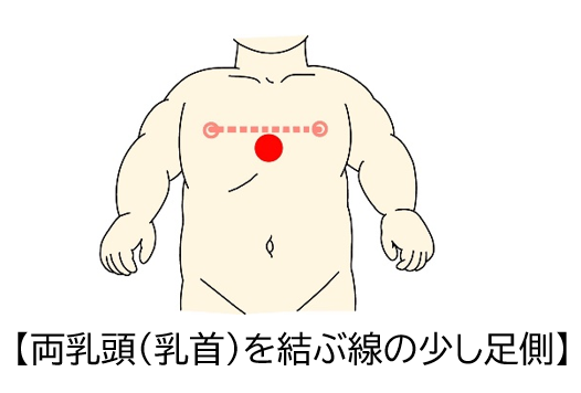 陥没乳頭・陥没乳首を治す方法、他院修正事例紹介とQ&A | 横浜市鶴見の形成・美容外科 エムズクリニック