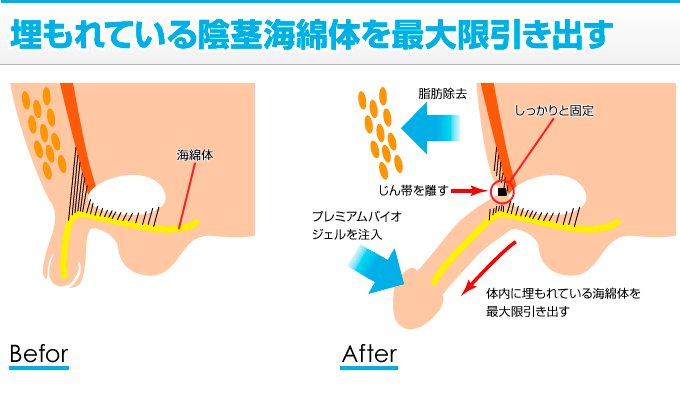 ちんこ14cmって巨根？それとも平均？女性はどう思ってるの？