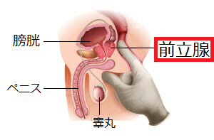 前立腺マッサージのやり方をポイント・コツ｜注意点もあわせて解説！ – 東京で稼げる！風俗求人は【夢見る乙女グループ】│