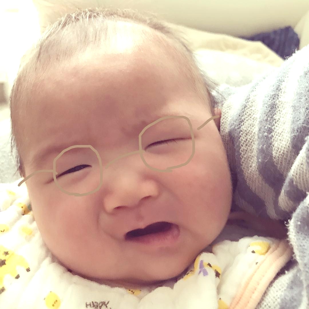 茶色いあざが生まれつきできるのはなぜ？原因や治療法を解説赤ちゃん・子供のあざ治療なら最新レーザー治療×形成外科専門医の大阪梅田形成クリニック