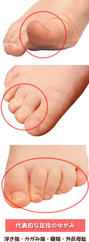 お部屋にふんわり優しく馴染む 国産 アクリルの手形 足形 フォトフレーム メモリアルエンジェル クラウド 赤ちゃん 手形 足型 インク キットスタンプ ベビー メモリアル 赤ちゃん 手形 足形 出産祝い 出産内祝い 内祝い 出産 お返し 名入れ ハーフバースデー１歳