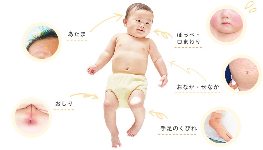 赤ちゃんが顔をぶつけたらできたあざはいつ消える？あざができる原因や程度の見方を徹底解説