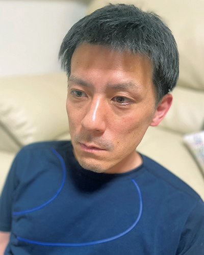 男性が老けて見える原因は？フェイスリフトで若見えを実現 - 渋谷の美容外科・美容整形クリニック