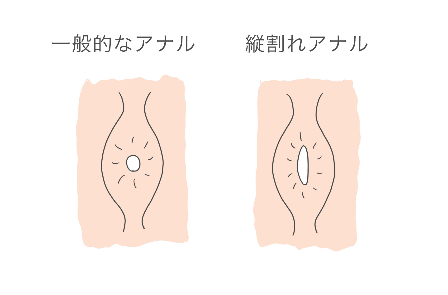 アナル洗浄（直腸洗浄）とは？アナニー前に行うアナルの準備 | アネドラ