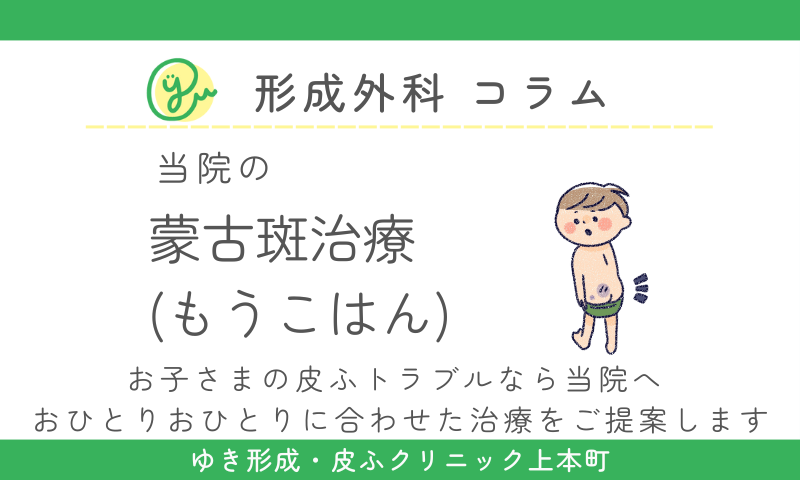 お尻以外の「異所性」蒙古斑の特徴と治療方法 - 小児科オンラインジャーナル