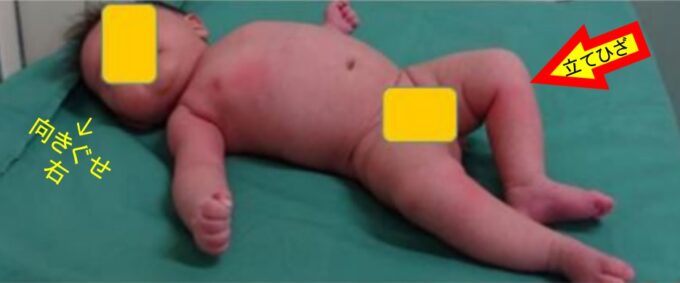 赤ちゃんはみんな扁平足！？大人になるにつれて変わる足裏の秘密湘南巻き爪矯正院 久里浜院