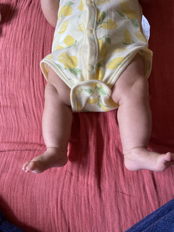 赤ちゃんの股関節脱臼 ―正しい知識と早期発見のために―日本小児整形外科学会